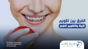 ما الفرق بين التقويم الزينة والتقويم الطبي؟ | المركز الطبي لرعاية الأسنان