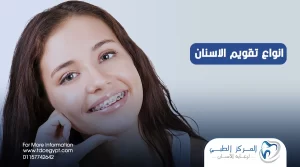 أفضل أنواع تقويم الأسنان وفوائدها وأضرارها | المركز الطبي لرعاية الأسنان