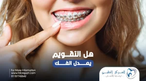هل التقويم يعدل الفك؟ | المركز الطبي لرعاية الأسنان
