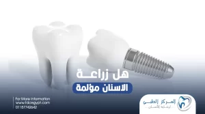 هل زراعة الأسنان مؤلمة؟ | المركز الطبي لرعاية الأسنان