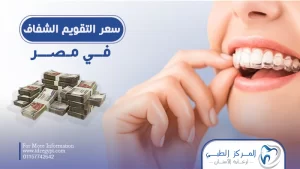 سعر التقويم الشفاف في مصر لعام 2023