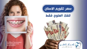 سعر تقويم الأسنان للفك العلوي فقط | المركز الطبي لرعاية الأسنان