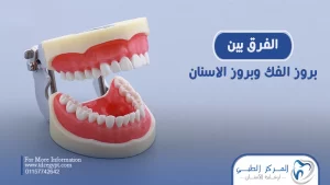 الفرق بين بروز الفك وبروز الأسنان