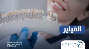 انواع الفينير، السلبيات والمميزات