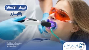 تبييض الاسنان بالليزر