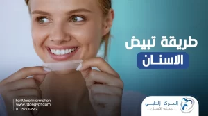 أفضل طريقة لتبيض الاسنان