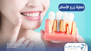 عملية زرع  الأسنان، المميزات والعيوب