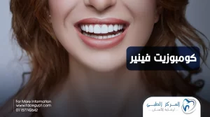 كومبوزيت فينير، المميزات، الانواع، والسعر
